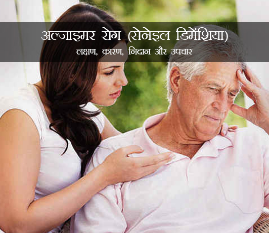 Alzheimer’s Disease in Hindi Alzheimer’s Disease in Hindi